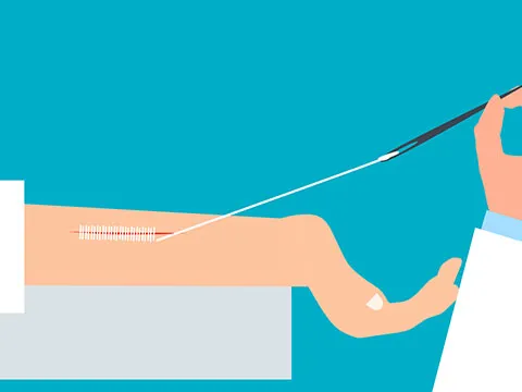 Taller Suturas Avanzadas